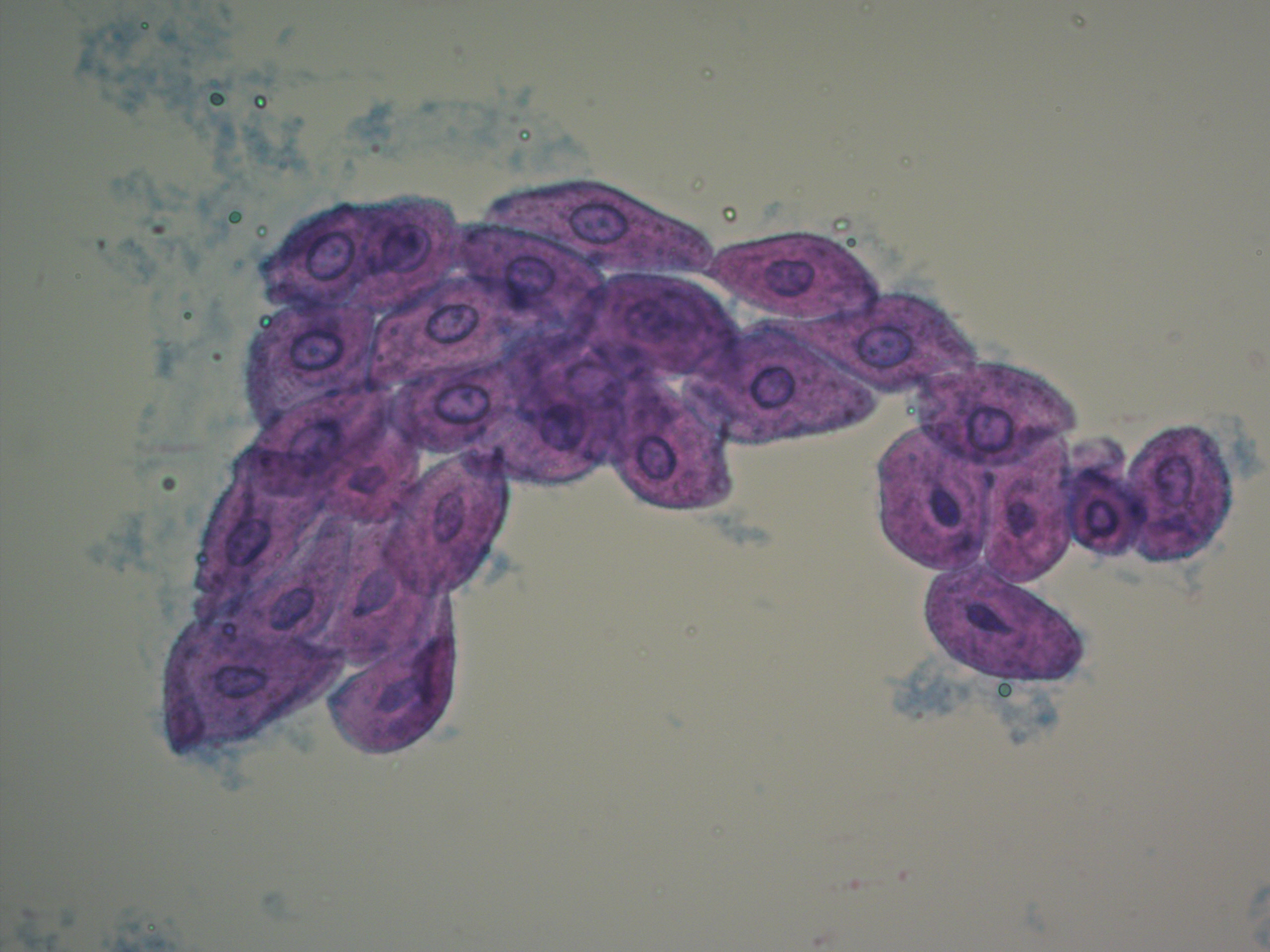 Переходный эпителий в моче у кошки, собаки - фото, признаки | Атлас ...